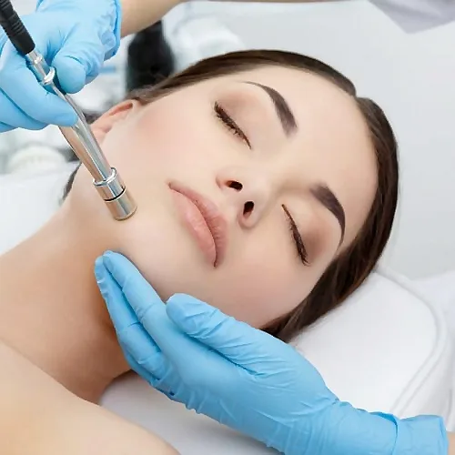 Reveal Radiant Skin with Microdermabrasion: Los Angeles Experts